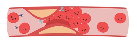 川西なかお内科　高血圧